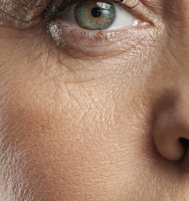 Anti-Wrinkle Treatments